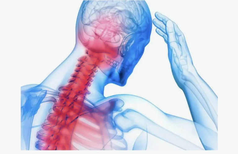 Schwindel Ursachen Halswirbelsäule